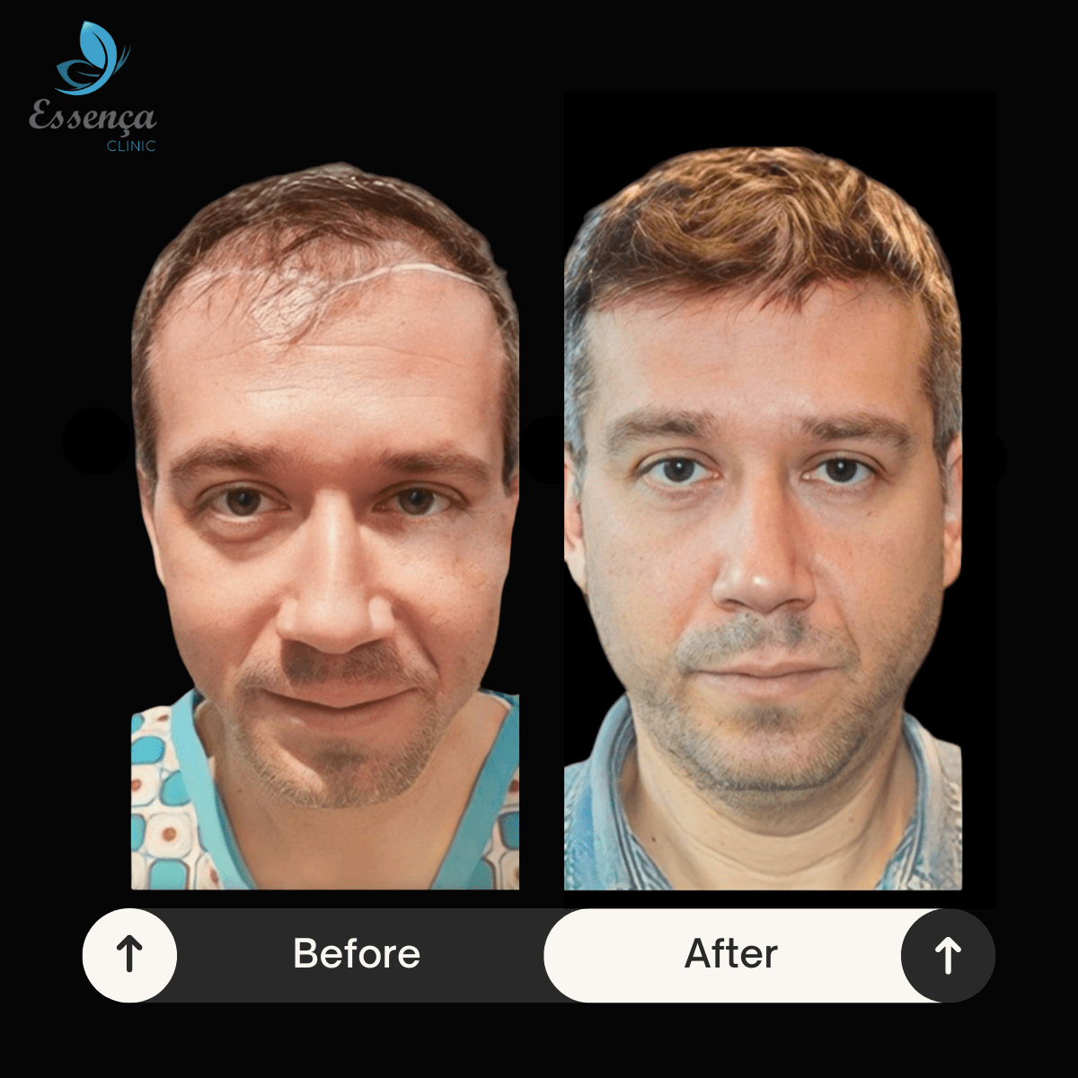 Before After Dr. Sema Kızıldağ (3)-min