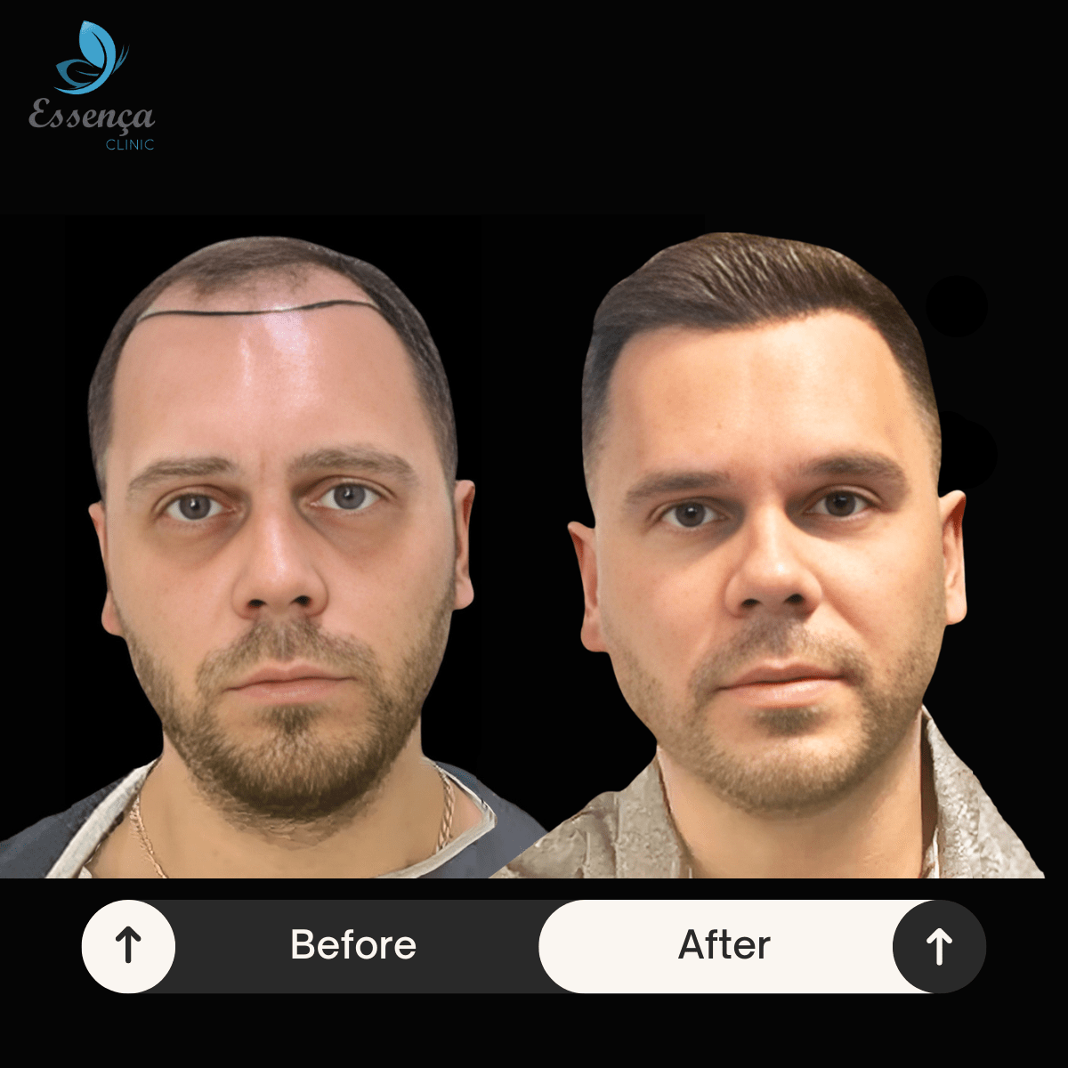 Before After Dr. Sema Kızıldağ (6)-min