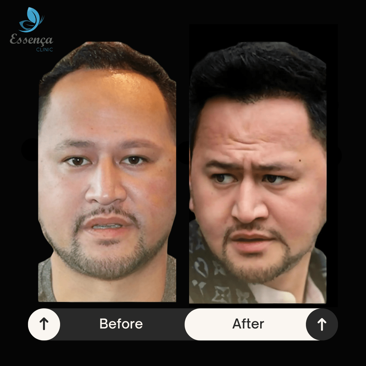 Before After Dr. Sema Kızıldağ (7)-min