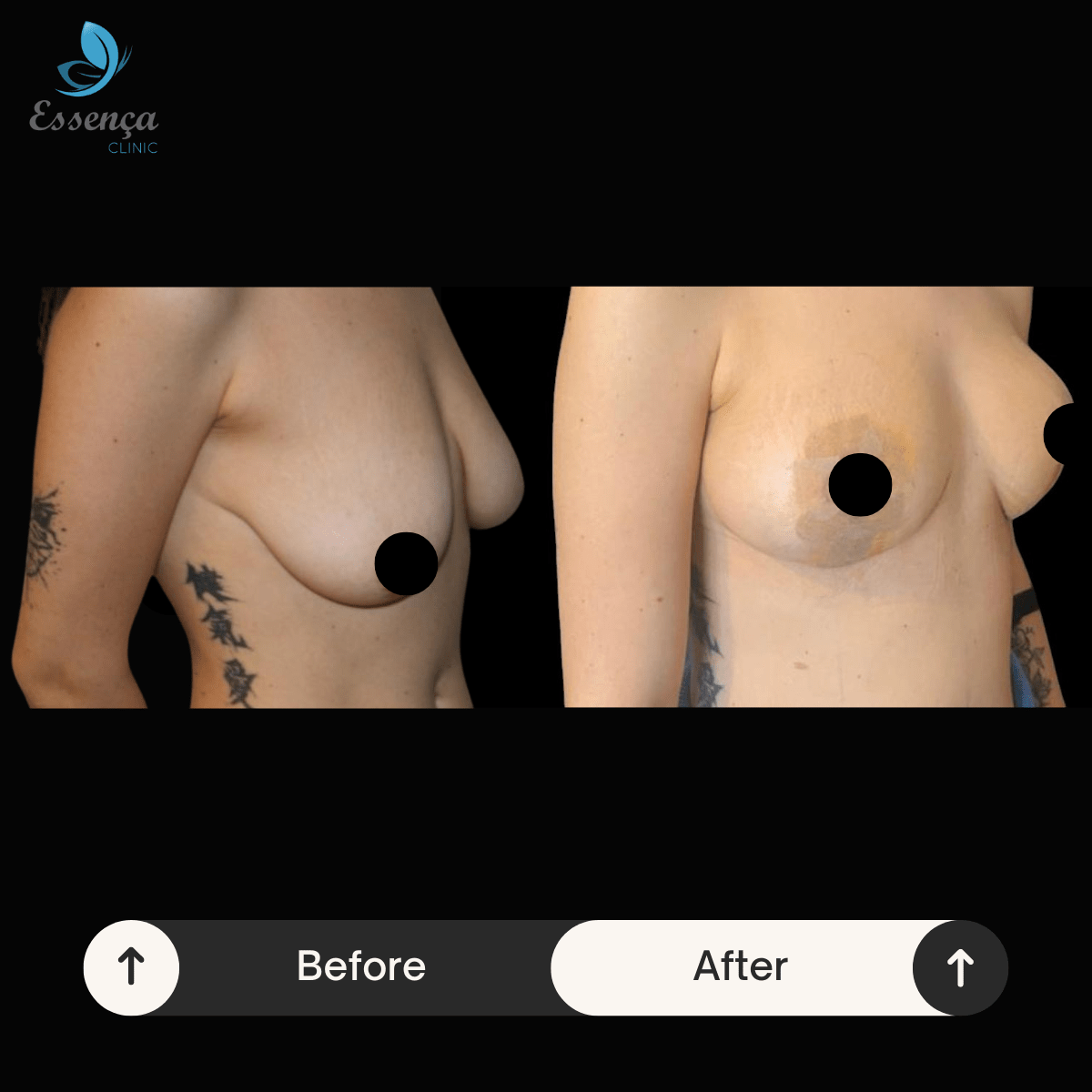 Before After Dr. Sener kucuk (12)-min