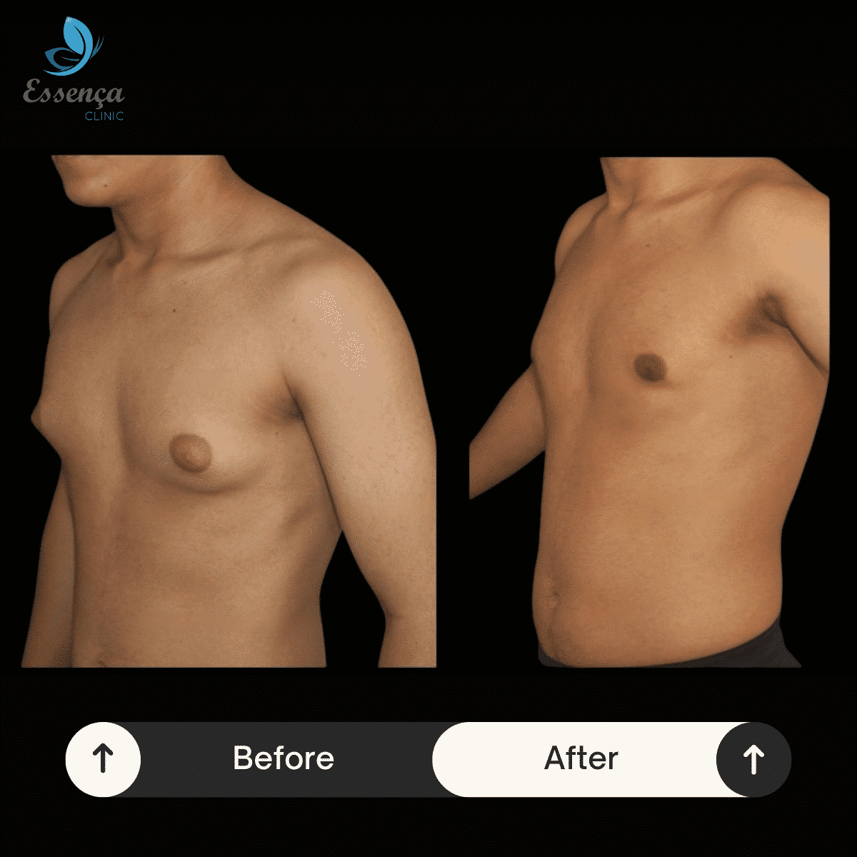 Before After Dr. Sener kucuk (18)-min
