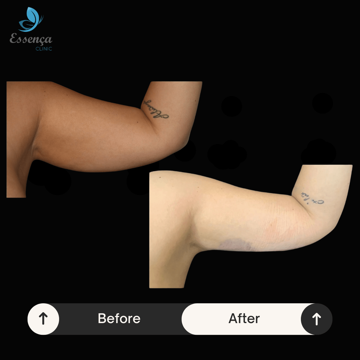 Before After Dr. Sener kucuk (20)-min