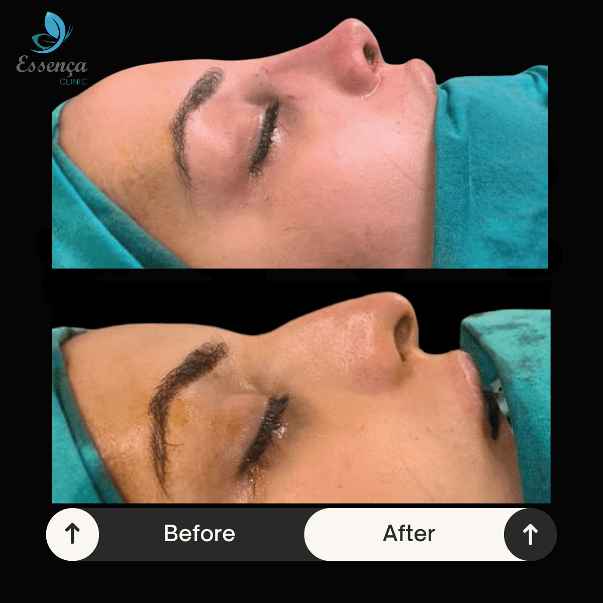 Before After Dr. Sener kucuk (21)-min