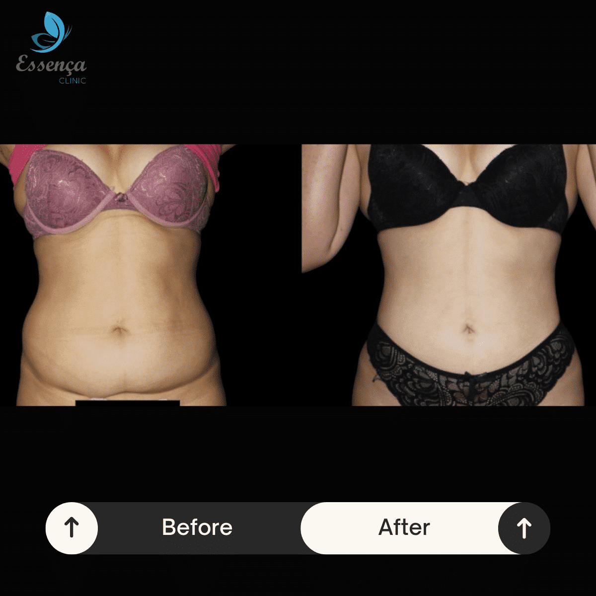 Before After Dr. Sener kucuk (32)-min