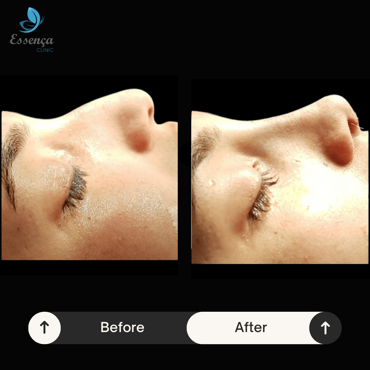 Before After Dr. Sener kucuk (36)-min