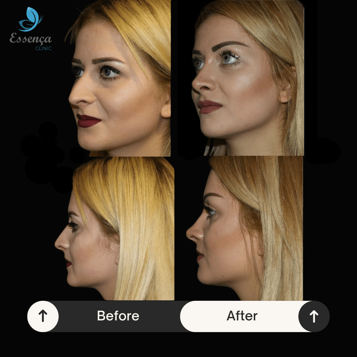 Before After Dr. Sener kucuk (37)-min