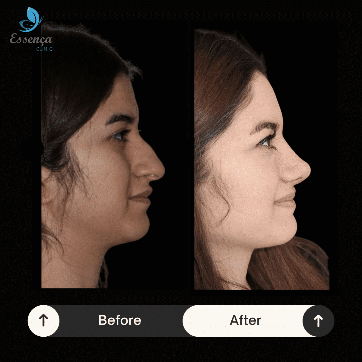 Before After Dr. Sener kucuk (38)-min