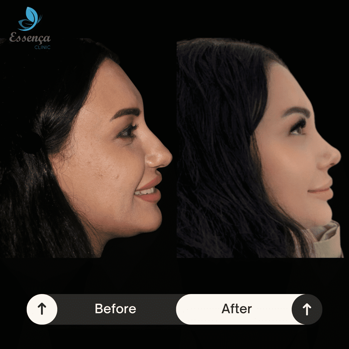 Before After Dr. Sener kucuk (39)-min