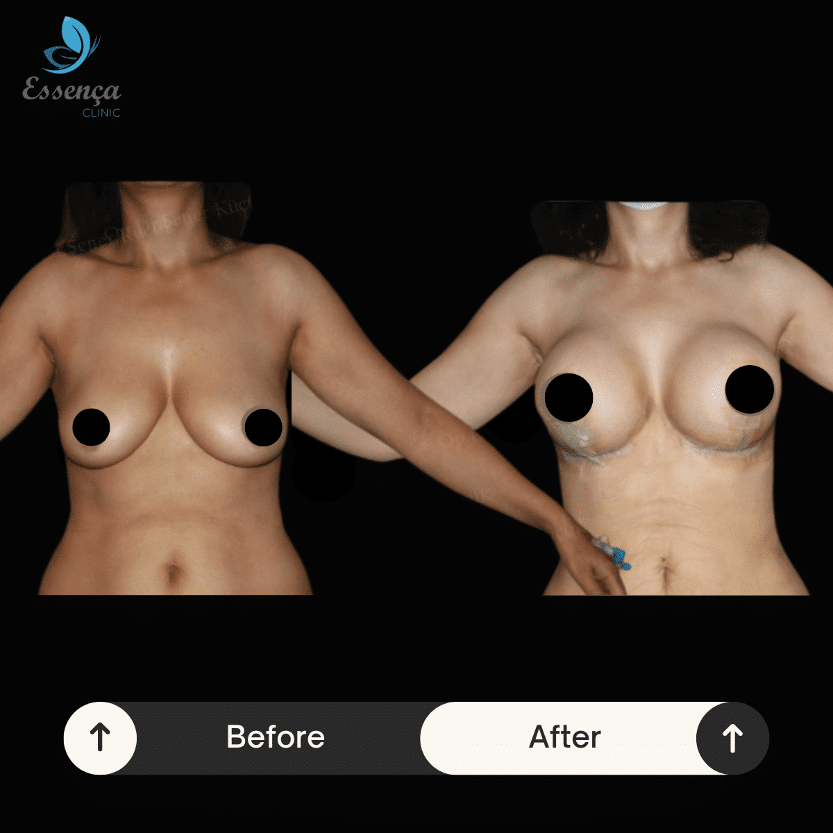 Before After Dr. Sener kucuk (4)-min
