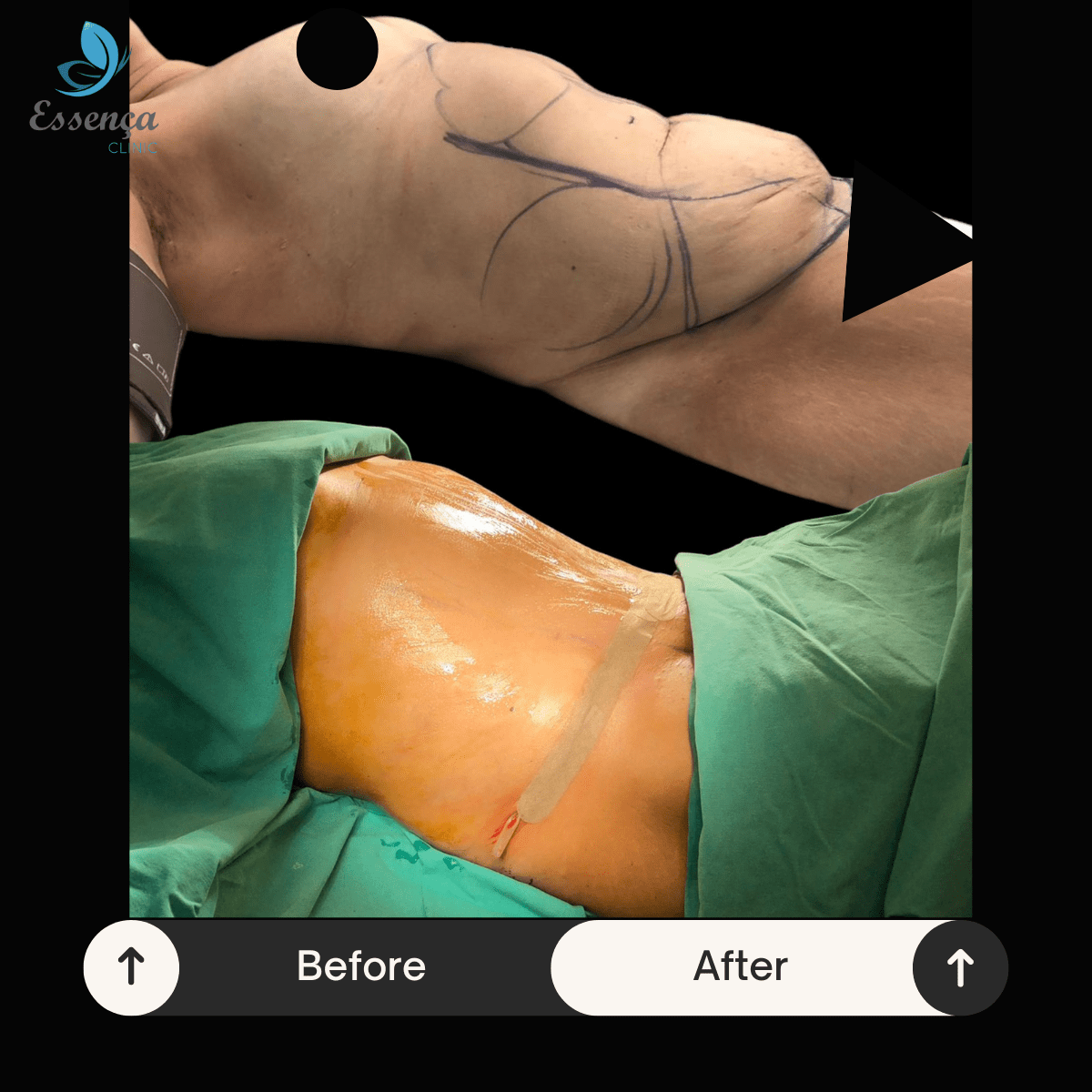 Before After Dr. Sener kucuk (46)-min