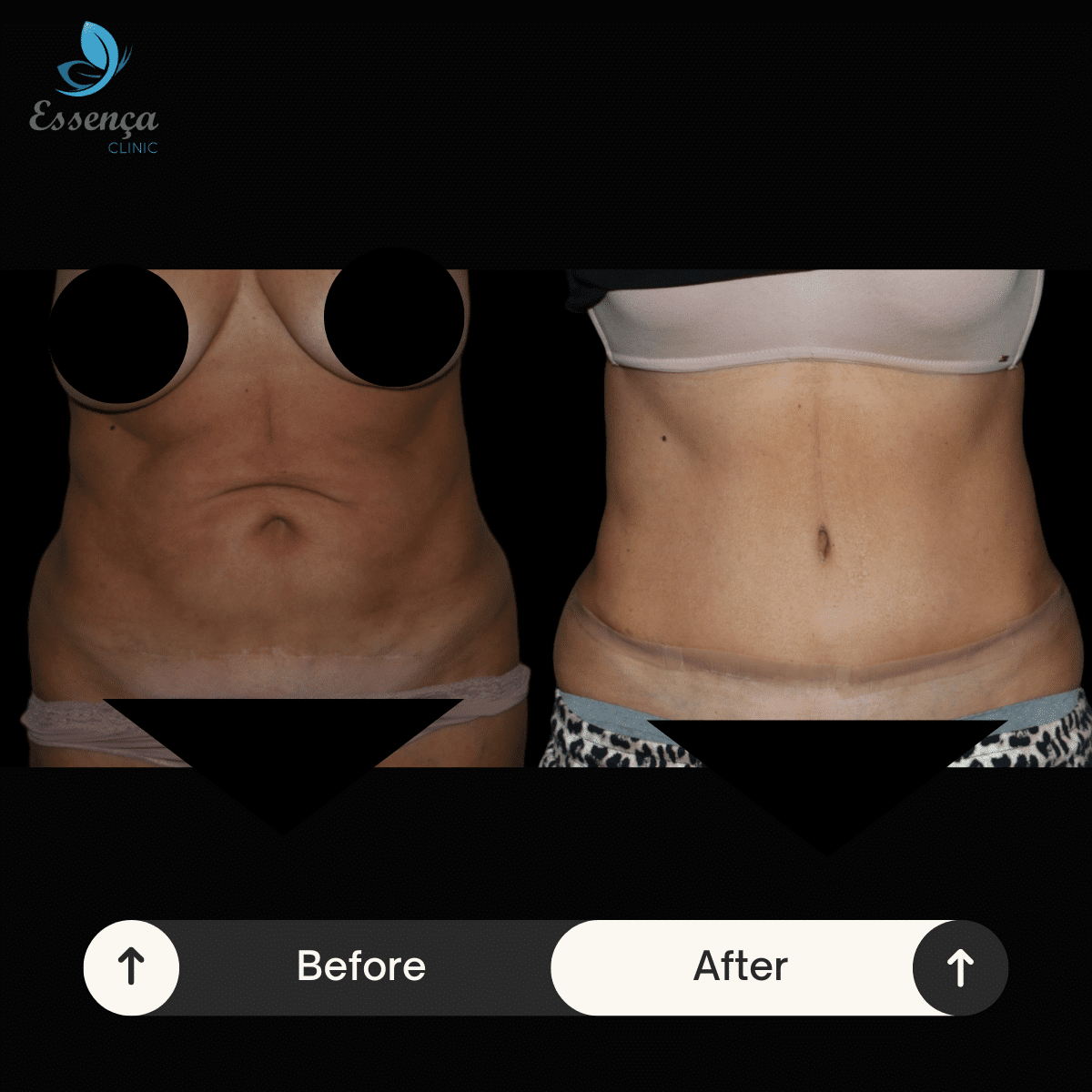 Before After Dr. Sener kucuk (47)-min
