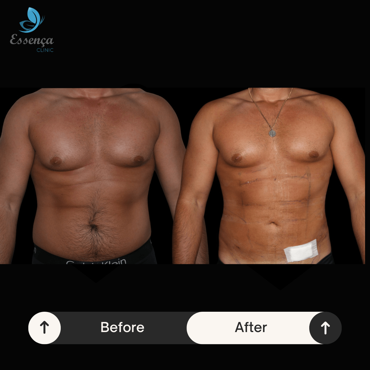 Before After Dr. Sener kucuk (49)-min
