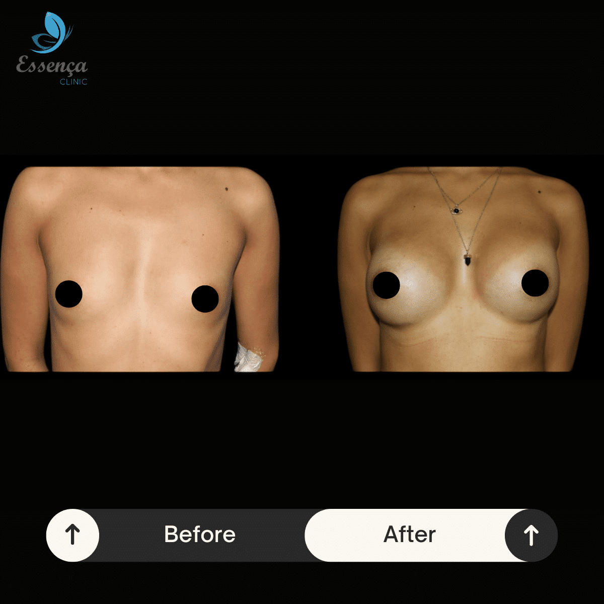 Before After Dr. Sener kucuk (9)-min