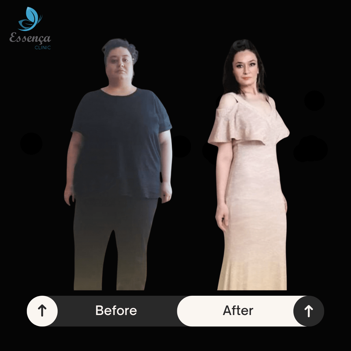 Before After Dr. Vahit Mutlu (3)-min