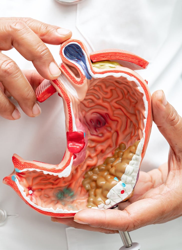 https://essencaclinic.com/wp-content/uploads/2025/01/Gastric-sleeve.jpg