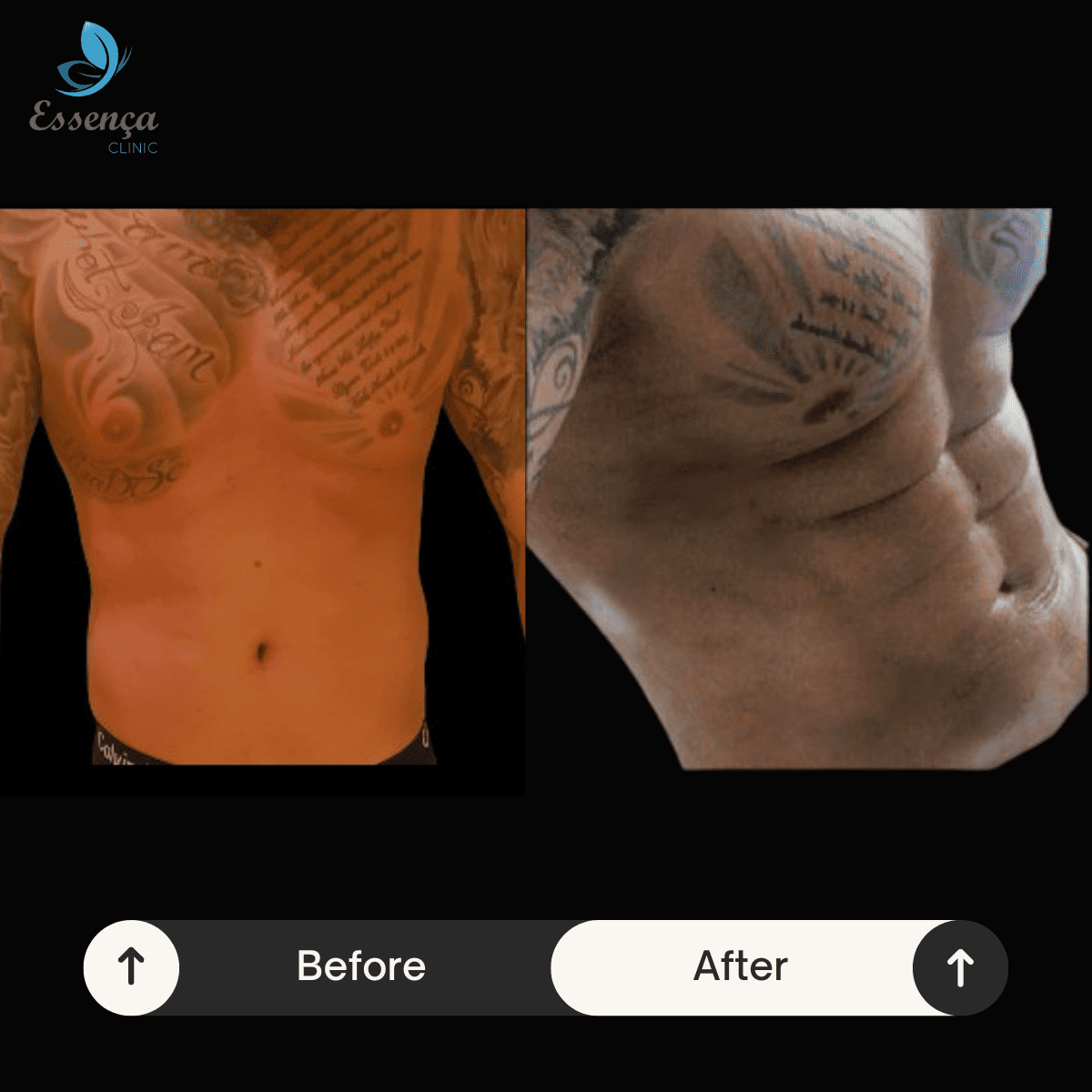 Six Packs Surgery (3)