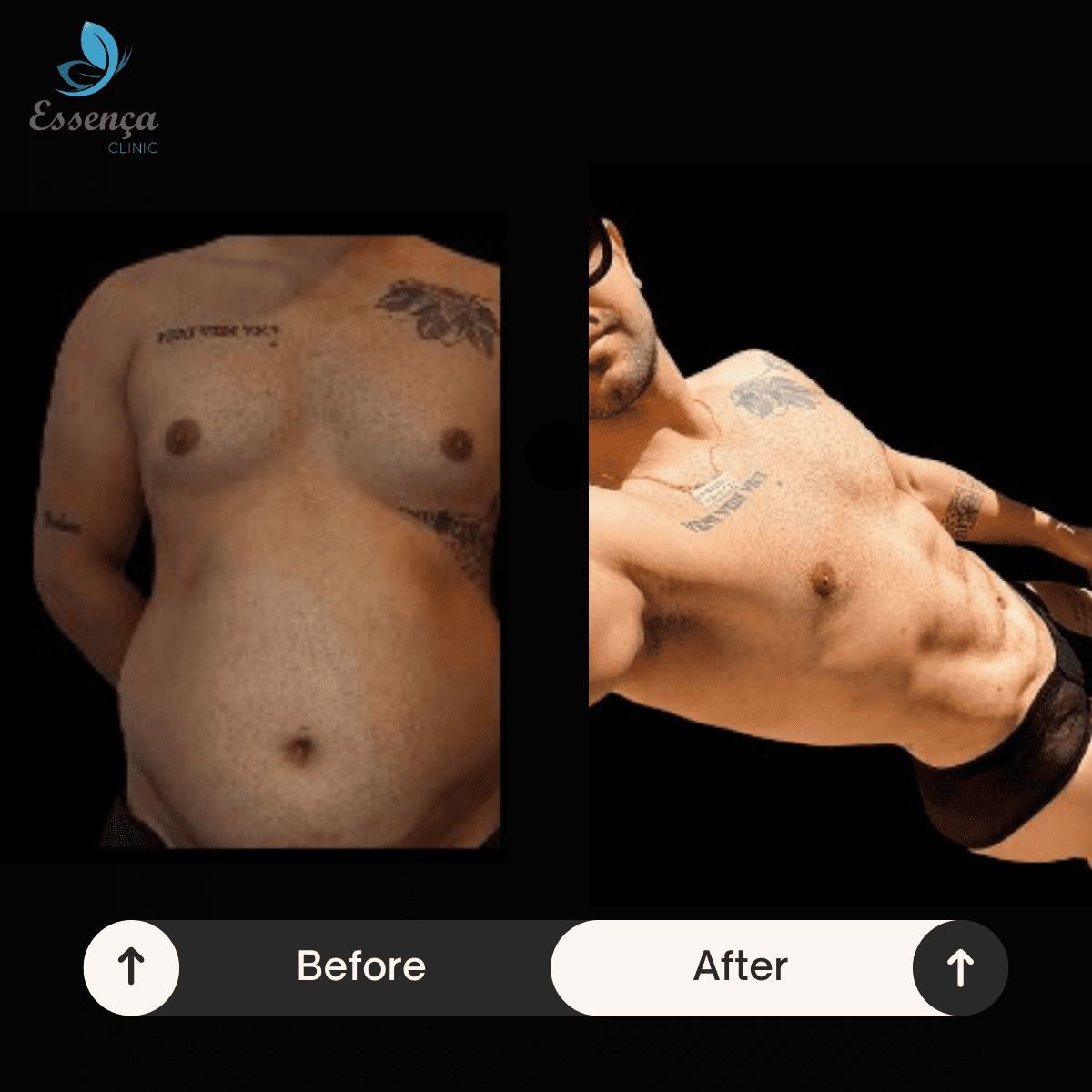 Six Packs Surgery (4)